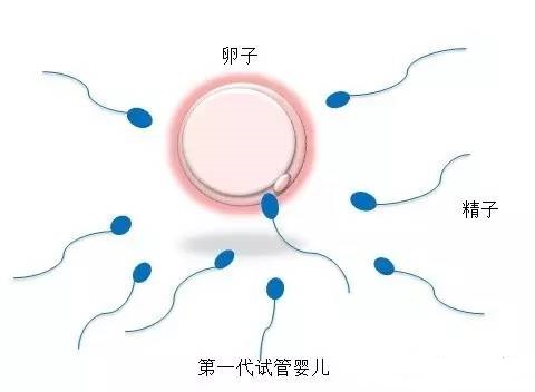 供卵代生网